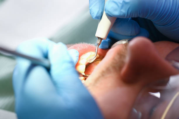 Best Emergency Denture Repair in Anza, CA