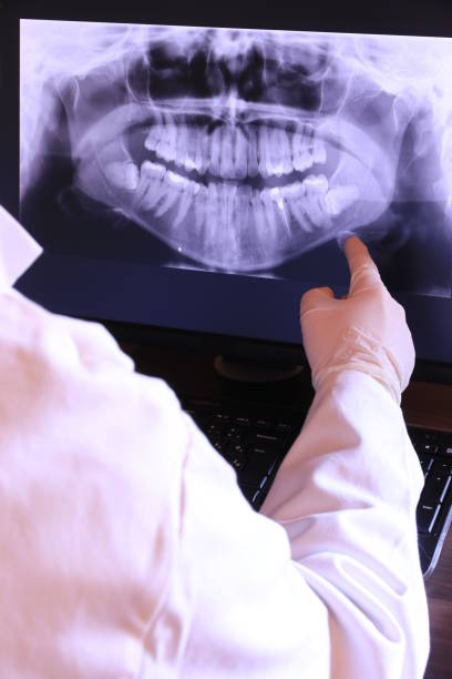 Best Emergency Wisdom Tooth Extraction in Anza, CA